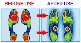 🔥 Today’s Must-Have – Don’t Miss Out!Women's Summer Wedge Sandals with Floral Embellishments