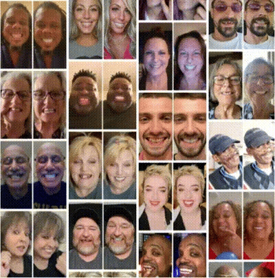 NESLEMY-🦷Advanced Customized Full Denture Set🦷 (⏰Limited time discount last 30 minutes⏰)